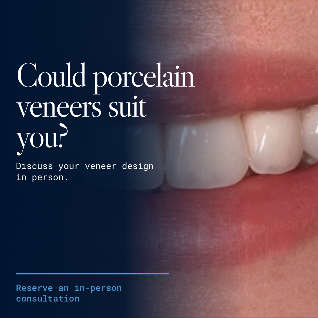 Second finished Porcelain Veneers Sydney image ad